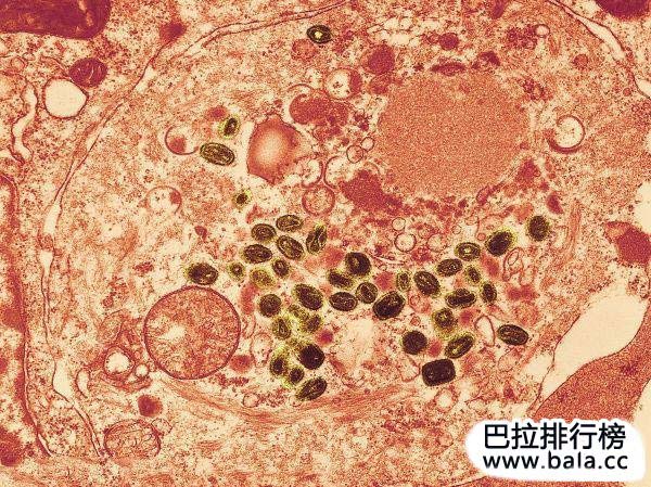世界上第一恐怖的病毒 全球十大病毒排名