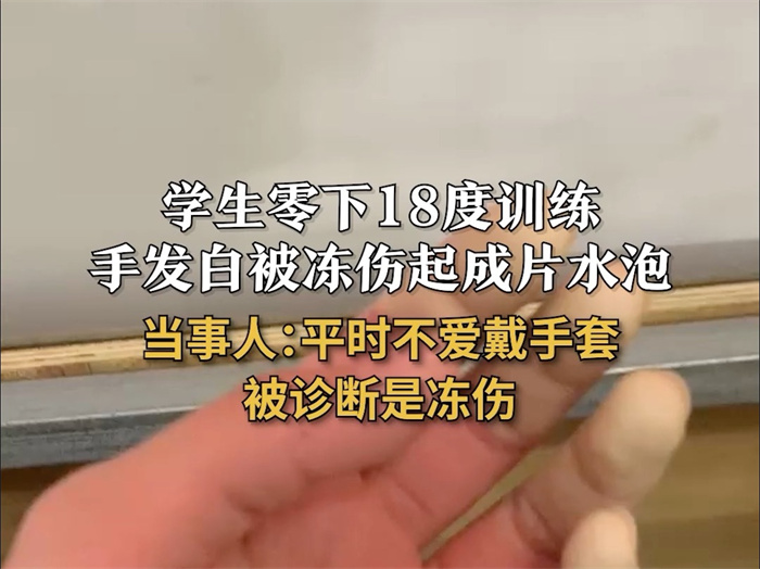 女孩零下18度户外光手跑步险截肢 出现冻伤该怎么办
