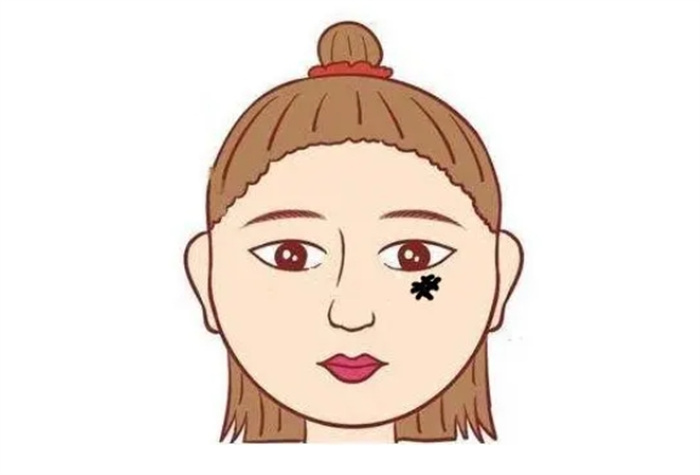 脸上五种常见的凶纹，财气不上门，子嗣不兴，一毁3代人！