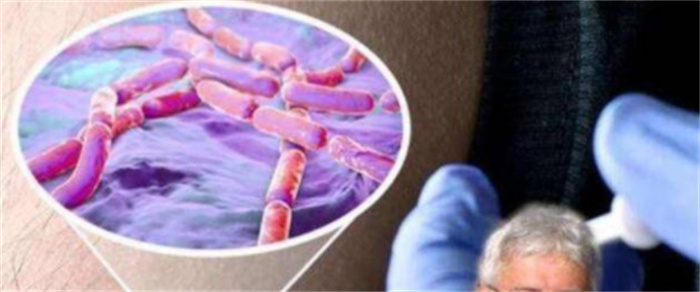 俄罗斯科学家为获永生  注射350万年前猛犸象细菌  结果怎样