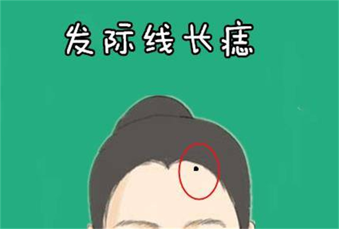 女人发际有痣代表着什么 感情运势怎么样（很好）