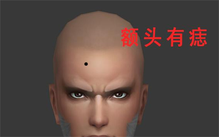 男人额头长痣财运旺盛吗 事业运势发展怎么样（很好）