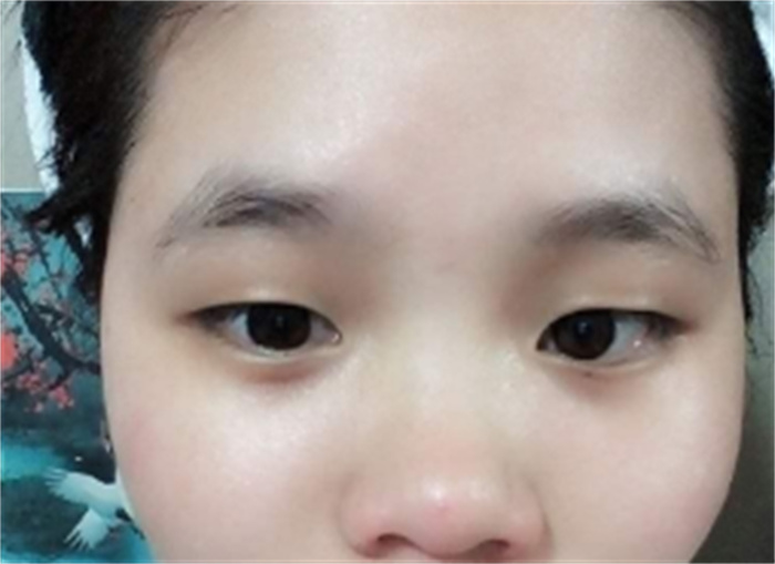 塌鼻子的人真的是穷命吗 什么鼻子财运差（鼻孔外漏）