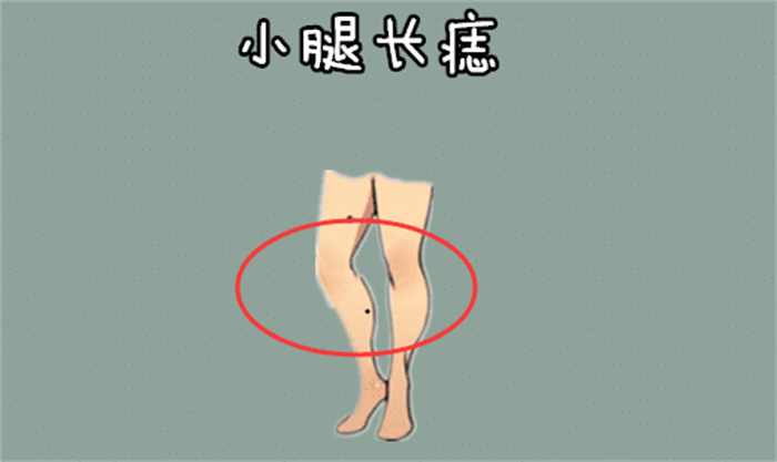 小腿有痣的人代表什么 哪里长痣有福气（脚心）