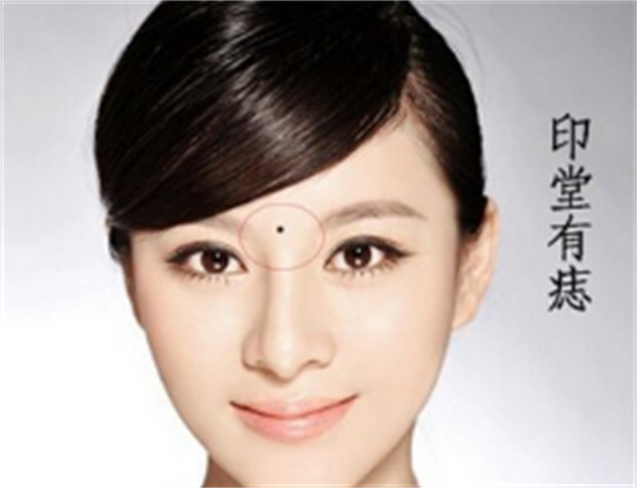 印堂有痣的女人好吗 印堂有痣财运如何（旺盛）
