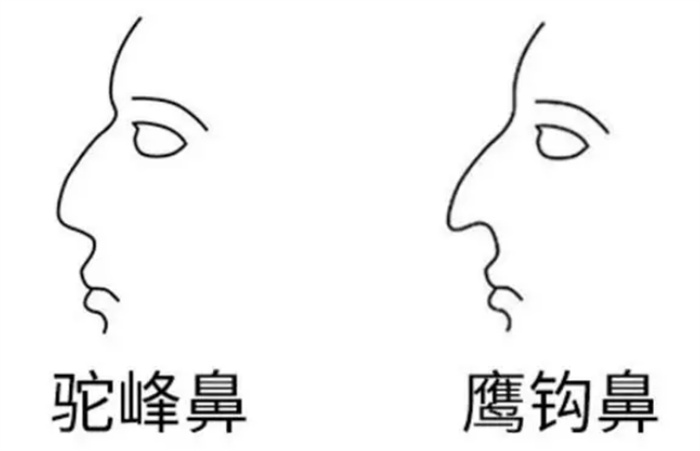 男人驼峰鼻命运好吗 整体运势如何（不错）