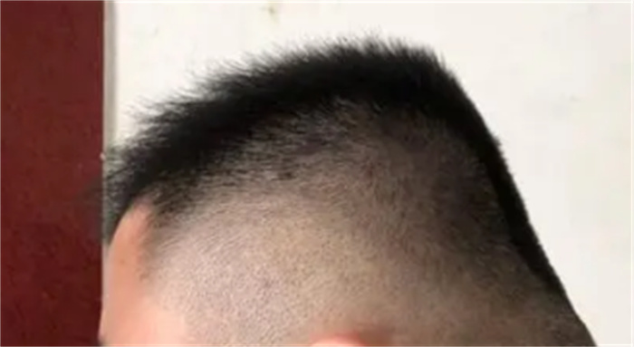 后脑勺扁平的人命好吗 什么头型的人命运好（圆头）
