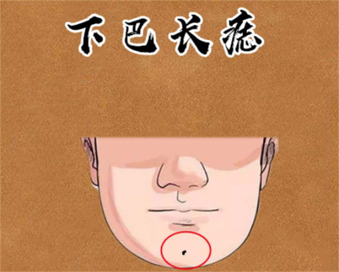 把富贵痣点了会不好吗 哪里的痣是富贵痣（下巴长痣）