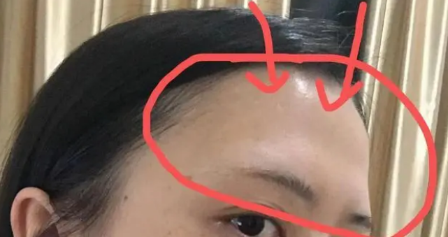最容易犯小人的面相 什么面相的人招小人（额头凹陷）