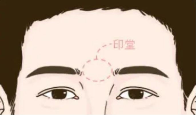 印堂有个小圆坑面相好吗 各方面的运势如何（不好）
