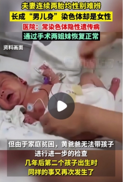 夫妻连生两胎均患怪病性别难辨 男儿身子却是女孩