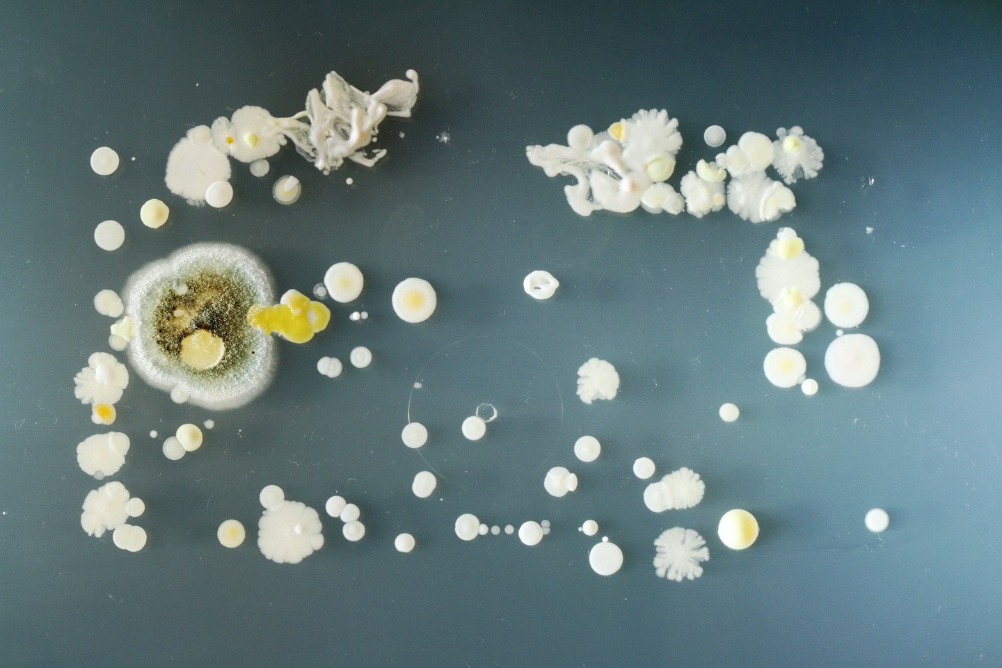 科学家有多疯狂？居然给自己注射细菌（永生实验）