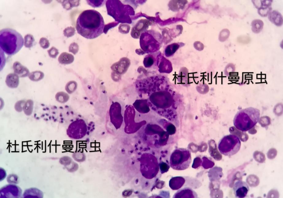 靠吃人肉为生的寄生虫，在美国蔓延，被感染者面部溃烂痛不欲生？