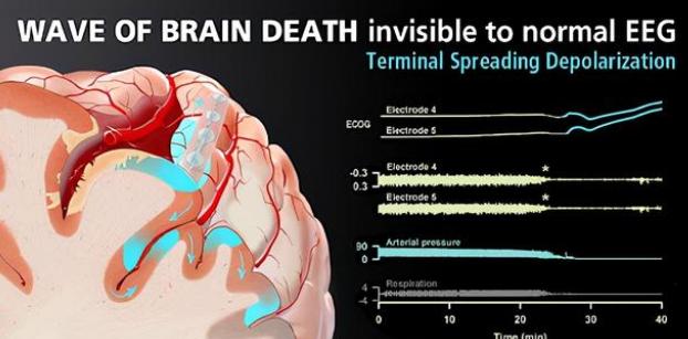 人死后竟然能放屁？这只是正常操作，有的尸体还能生孩子呢！
