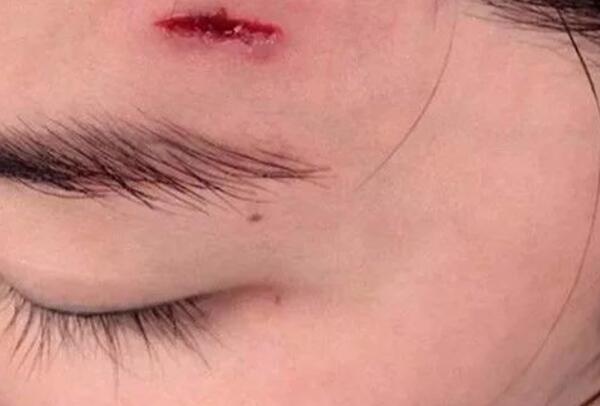 破相之人必有大相是什么意思?虽对面容有损，却对命运有益