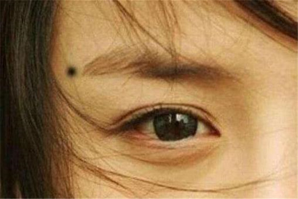 女人10处有痣是富贵痣 每一个痣都代表着富贵（面相学）