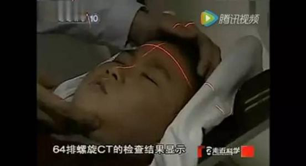 僵尸男孩怎么回事 龇牙咧嘴爱吸血犹如僵尸附体