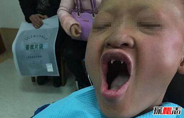 世界上最有病的人 揭秘世界十大最奇怪疾病